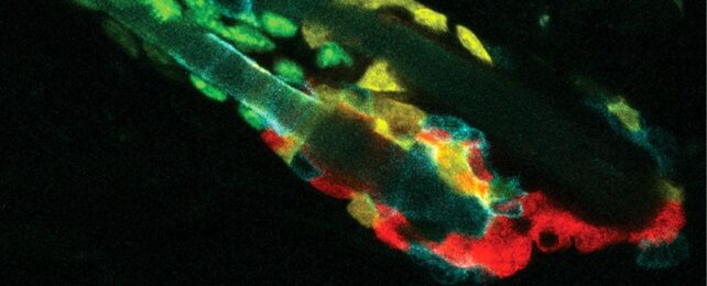 Dead Cells Are Cleared From The Body in a Surprisingly Cannibalistic Way