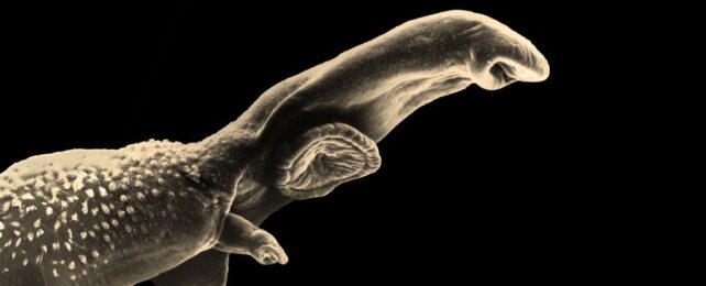 New AI Breakthrough Can Finally Detect Parasitic Worm Infections